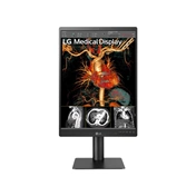 LG 21HQ513D-B 3MP IPS diagnosztikai monitor