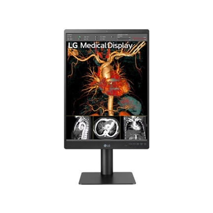 LG 21HQ513D-B 3MP IPS diagnosztikai monitor