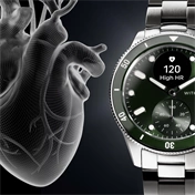 Withings Scanwatch Nova 42mm - Green